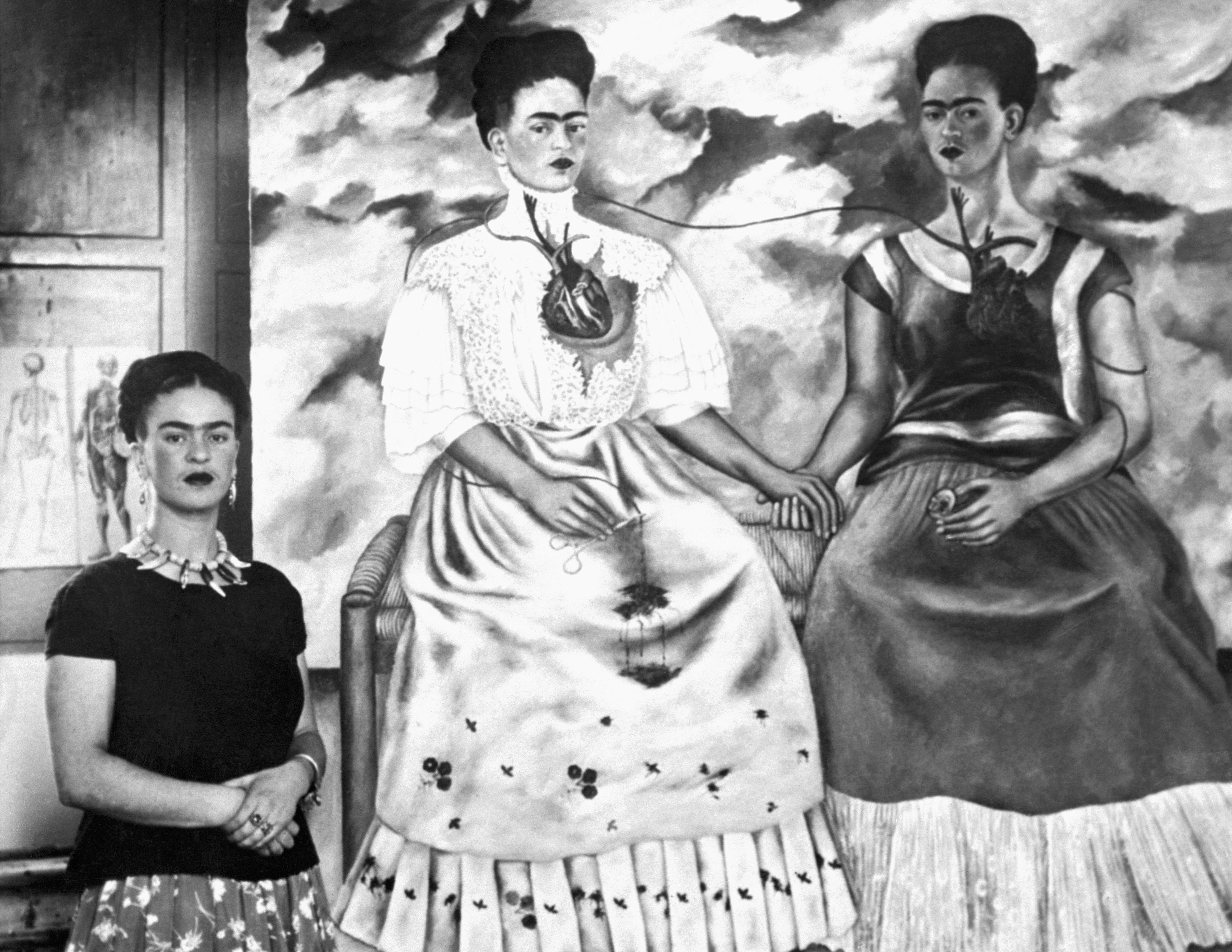 How a Devastating Accident Changed Frida Kahlo's Life and Inspired Her